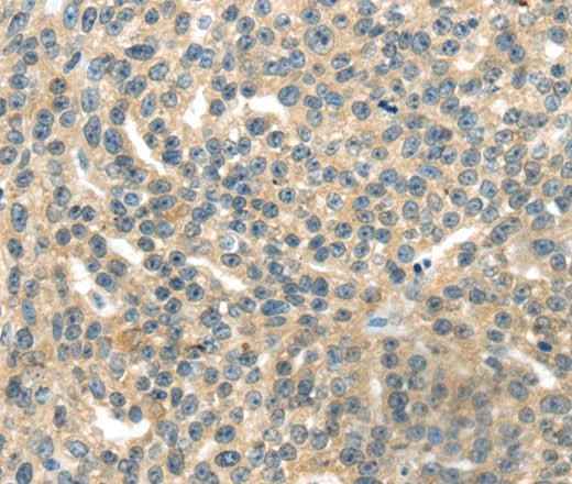 Anti-Human/Mouse/Rat RASA2 Antibody