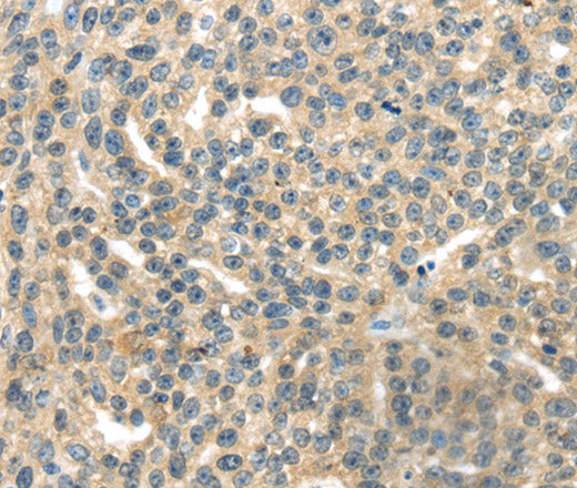 Anti-Human/Mouse/Rat RASA2 Antibody - ABMIUM