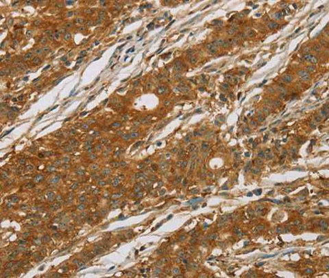 Anti-Human CYP27A1 Antibody