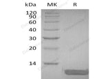 Recombinant Human DEFB104A Protein - ABMIUM