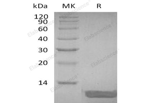 Recombinant Human DEFB104A Protein - ABMIUM