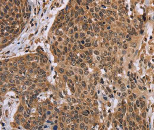Anti-Human EDN2 Antibody