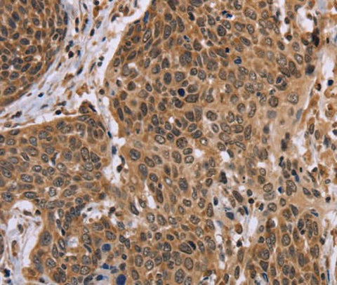 Anti-Human EDN2 Antibody - ABMIUM