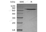 Recombinant Human SENP8 Protein (His Tag) - ABMIUM