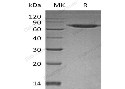 Recombinant Human SENP8 Protein (His Tag) - ABMIUM