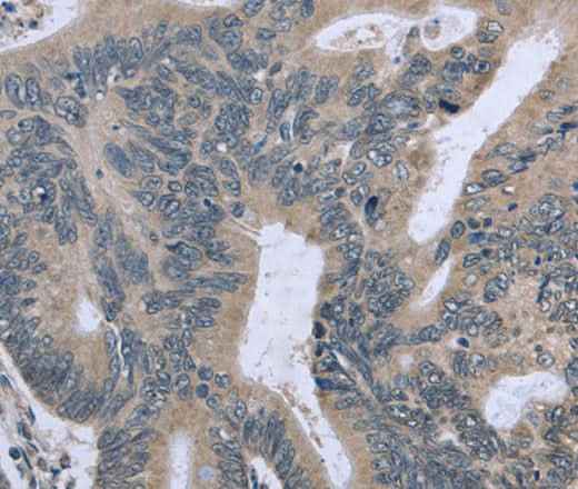 Anti-Human/Mouse BMX Antibody