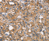 Anti-Human CEACAM6 Antibody - ABMIUM