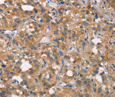Anti-Human CEACAM6 Antibody