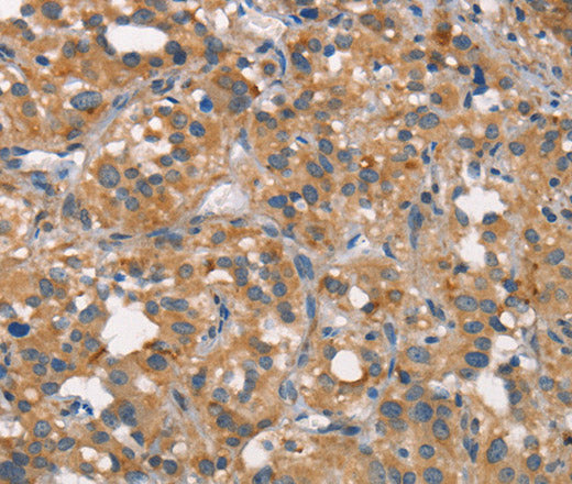 Anti-Human CEACAM6 Antibody - ABMIUM
