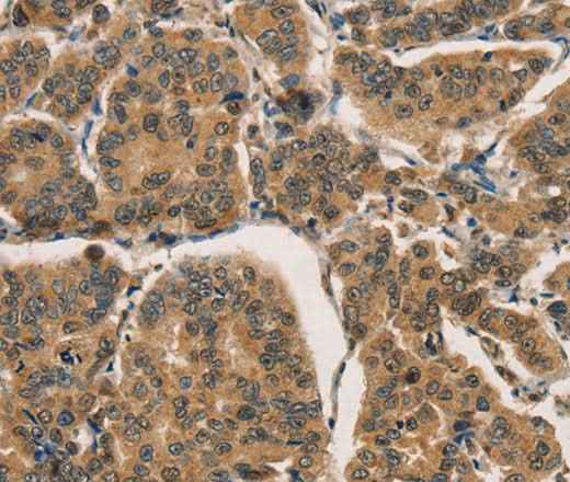Anti-Human/Mouse CTNNBIP1 Antibody
