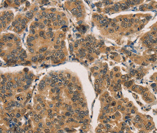 Anti-Human/Mouse CTNNBIP1 Antibody - ABMIUM