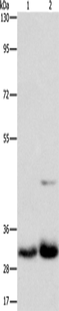 Anti-Human MPG Antibody - ABMIUM