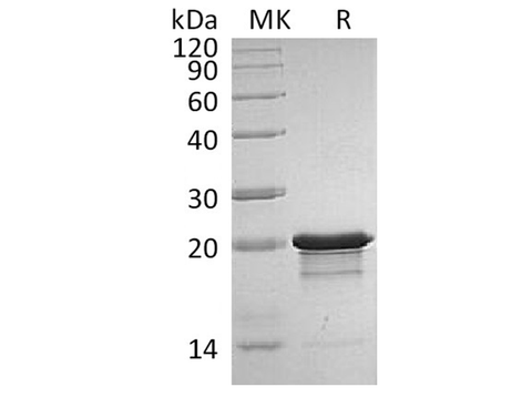 Recombinant Human/Mouse FGF-8b/FGF8B Protein - ABMIUM