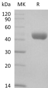 Recombinant Mouse CD112/Nectin-2 Protein (His Tag) - ABMIUM