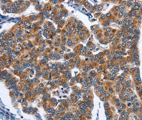 Anti-Human/Mouse/Rat CADM3 Antibody