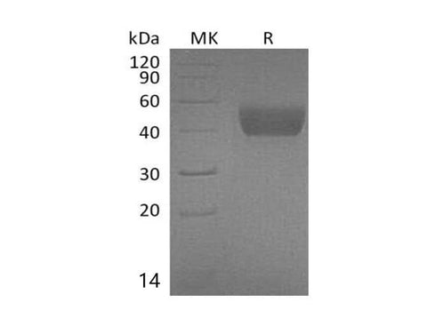 Recombinant Mouse FSTL1 Protein (His Tag) - ABMIUM