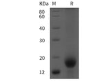 SDS-PAGE analysis of Human CD59 proteins, 2 μg/lane of Recombinant Human CD59 proteins was resolved with SDS-PAGE under reducing conditions, showing bands at 15 kDa.