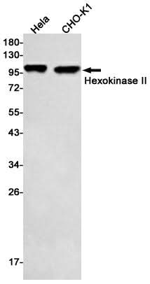 Western blot detection of Hexokinase II in Hela,CHO-K1 cell lysates using Hexokinase II Rabbit mAb(1:500 diluted).Predicted band size:102kDa.Observed band size:102kDa.