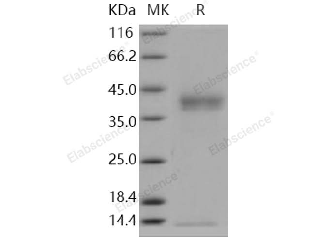 Recombinant Human Pancreasin/Marapsin/PRSS27 Protein (His Tag) - ABMIUM