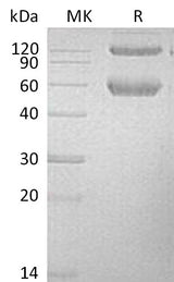 Recombinant Mouse BMPRIA/ALK-3 Protein (Fc & His Tag) - ABMIUM