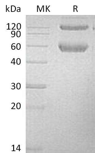 Recombinant Mouse BMPRIA/ALK-3 Protein (Fc & His Tag) - ABMIUM