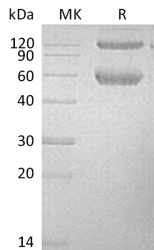 Recombinant Mouse BMPRIA/ALK-3 Protein (Fc & His Tag) - ABMIUM