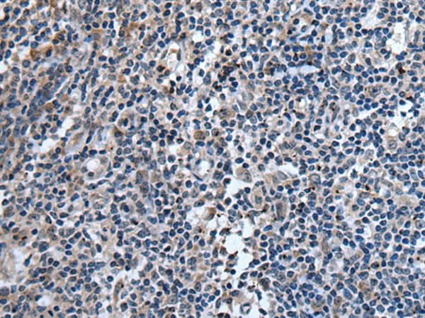 Immunohistochemistry of paraffin-embedded Human tonsil tissue using TNFSF18 Polyclonal Antibody at dilution of 1:45(×200)