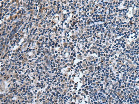 Immunohistochemistry of paraffin-embedded Human tonsil tissue using TNFSF18 Polyclonal Antibody at dilution of 1:45(×200)
