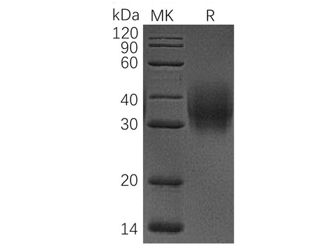 Recombinant Human CD47/IAP Protein (His Tag) - ABMIUM