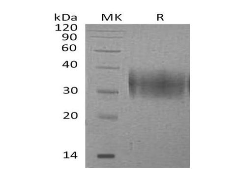 Recombinant Mouse B7-H5/Gi24/VSIR Protein (His Tag) - ABMIUM