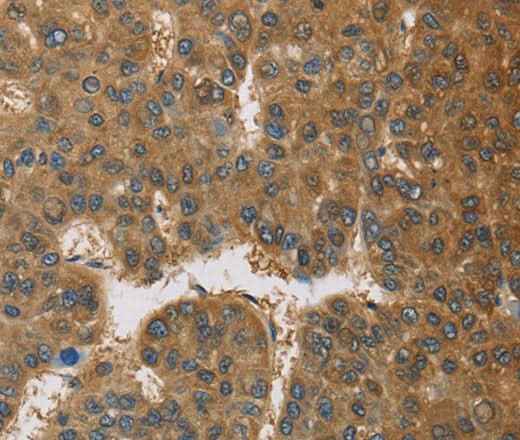Anti-Human TNFRSF10D Antibody