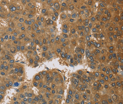 Anti-Human TNFRSF10D Antibody - ABMIUM