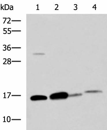 Western blot analysis of Human sigmoid tissue Mouse large intestine tissue Mouse small intestines tissue Mouse Pancreas tissue lysates using ZG16 Polyclonal Antibody at dilution of 1:800