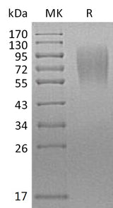 Recombinant Mouse LAMP1/CD107a Protein (His Tag) - ABMIUM