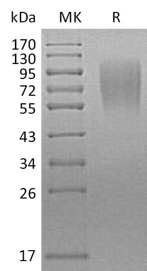 Recombinant Mouse LAMP1/CD107a Protein (His Tag) - ABMIUM