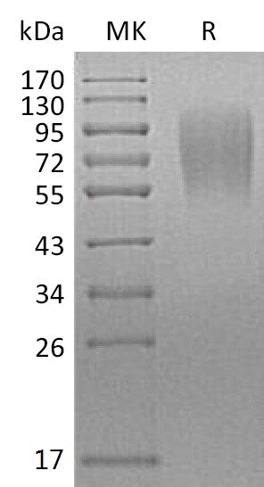 Recombinant Mouse LAMP1/CD107a Protein (His Tag) - ABMIUM