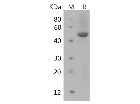 SDS-PAGE analysis of Rat Ager proteins, 2 μg/lane of Recombinant Rat Ager proteins was resolved with SDS-PAGE under reducing conditions, showing bands at 45 kDa.