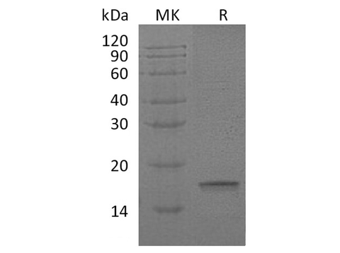 Recombinant Human Interleukin-18/IL-18 Protein - ABMIUM