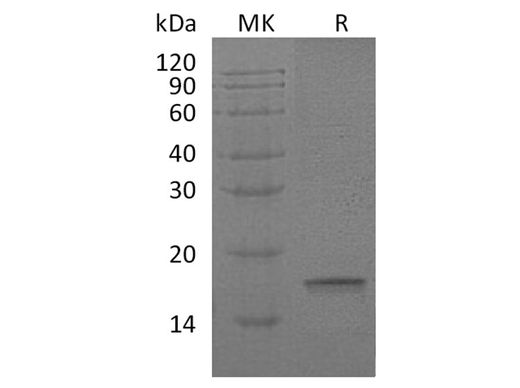 Recombinant Human Interleukin-18/IL-18 Protein - ABMIUM