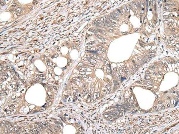 Anti-Human/Mouse GCNT2 Antibody