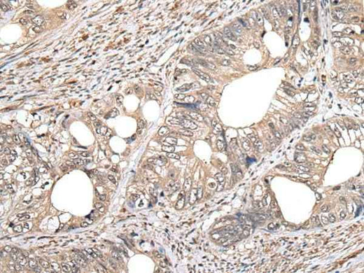 Anti-Human/Mouse GCNT2 Antibody