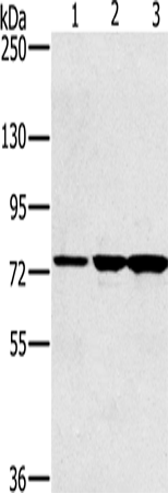 Anti-Human/Mouse KIRREL2 Antibody - ABMIUM