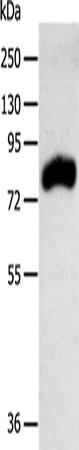 Anti-Human/Mouse RPAP3 Antibody - ABMIUM