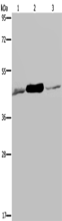 Anti-Human/Mouse/Rat IDH2 Antibody - ABMIUM