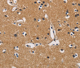 Anti-Human/Mouse/Rat CBY1 Antibody - ABMIUM