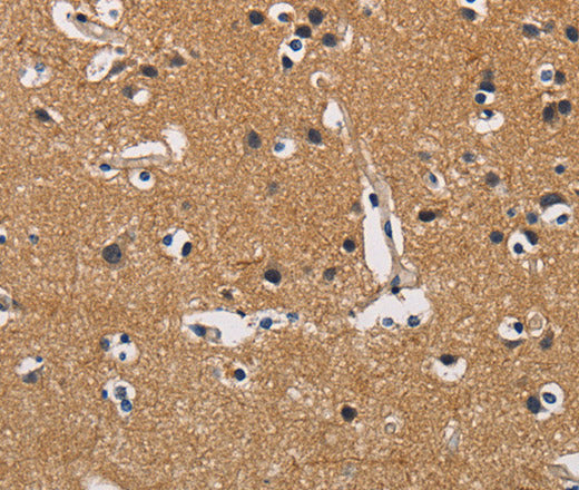 Anti-Human/Mouse/Rat CBY1 Antibody - ABMIUM