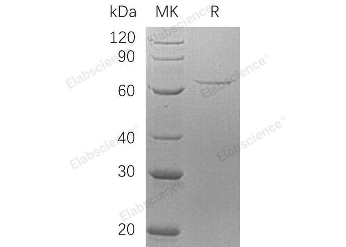 Recombinant Human AIFM1 Protein (His Tag) - ABMIUM