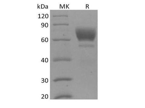 Recombinant Mouse Tyrosine-protein kinase receptor UFO/AXL oncogene/UFO (C-6His) - ABMIUM