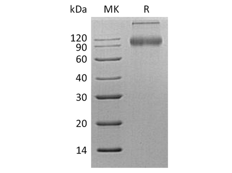 Recombinant Human CD200R1 Protein (Fc Tag) - ABMIUM