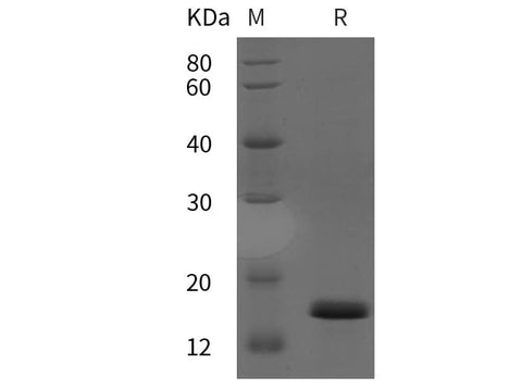SDS-PAGE analysis of Human BMP-7 proteins, 2 μg/lane of Recombinant Human BMP-7 proteins was resolved with SDS-PAGE under reducing conditions, showing bands at 15 kDa.